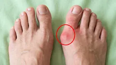 Rozlučte se s bolestí v nohou: 6 cviků, které uvolní vaše chodidla